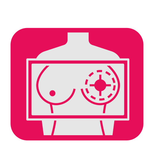 Gynae Onco Surgeon